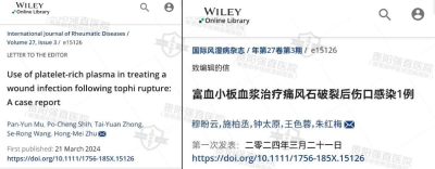 35由穆盼云、施柏丞、我院学术带头人「手术室主任钟太原和痛风科王色蓉等参与联合撰写的题为《富血小板血浆治疗痛风石破裂后伤口感染1例》的SCI文章被《国际风湿病杂志》收录。.png