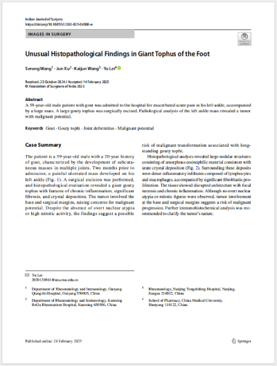 36由王色蓉主任等共同撰写的文章《Unusual Histopathological Findings in Giant Tophus of the Foot》(足部巨大痛风石的异常组织病理学表现)在SCI期刊《Indian Journal of Surgery》发表。.png